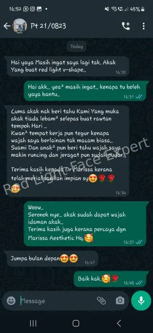 rl-vshape-testi1
