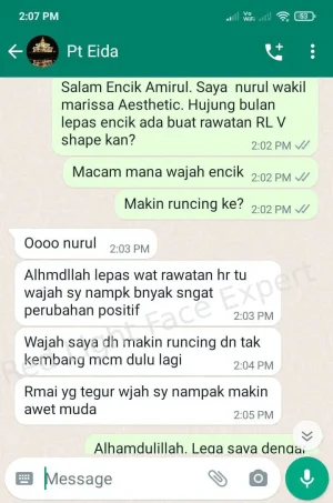 rl-vshape-testi2